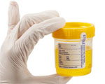 PCR urine
